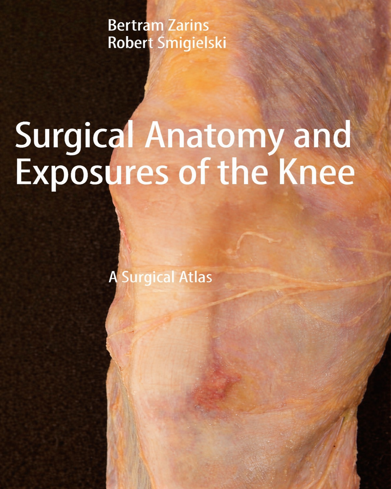Surgical Anatomy and Exposures of the Knee: A Surgical Atlas